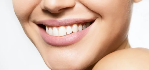 undergoing teeth whitening